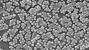 Für viele bakterielle Krankenhausinfektionen sind multiresistente Problemerreger verantwortlich. Hier im Bild: eine Staphylokokken-Kolonie.