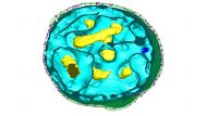 Die 3d-Modelle der Heidelberger Forschen zeigen eine relativ hohe Komplexität in der Bakterienzelle, hinsichtlich ihrer Membranstrukturen. Die vermeintliche Kernmembran ist keine.