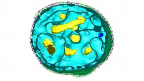 Die 3d-Modelle der Heidelberger Forschen zeigen eine relativ hohe Komplexität in der Bakterienzelle, hinsichtlich ihrer Membranstrukturen. Die vermeintliche Kernmembran ist keine.