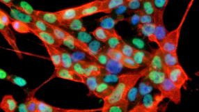 Mikroskopische Aufnahme induzierter neuronaler Stammzellen. Multipotente Stammzellen, die sich in verschiedene Gewebetypen verwandeln lassen, sind ein wichtiges Werkzeug der regenerativen Medizin.