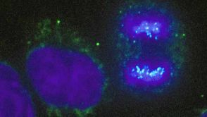 Sich teilende Zellen (rechts). Die Chromosomen sind blau eingefärbt.