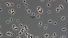 Überlebenskünstler aus Reinräumen der Raumfahrtindustrie: Die Mikrobe Tersicoccus phoenicis.