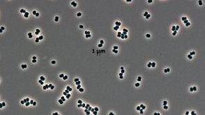 Überlebenskünstler aus Reinräumen der Raumfahrtindustrie: Die Mikrobe Tersicoccus phoenicis.