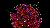 MOF-Komplexe sorgen für das genetische Gleichgewicht der X-Chromosome, wie Max-Planck-Forscher herausfanden. (im Bild: Immunfluoreszenzbild einer Kolonie weiblicher embryonaler Mausstammzellen)