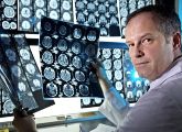 Moderne bildgebende Verfahren können die Diagnose der Alzheimer-Erkrankung verbessern.