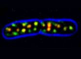 Deutsche Forscher haben die Konstruktion der Bakterienhülle entschlüsselt: Bakterienzelle mit mehreren Membranpatches aus einem dem MreB verwandten Protein, an welches das Leuchtprotein GFP gekoppelt wurde.