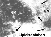 Forscher der Ruhr-Universität Bochum haben mittels der Immuntransmissions-Elektronen-Mikroskopie erstmals Eisenspeicher in Nervenzellen dokumentieren können.