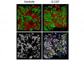 Zu sehen sind in der oberen Reihe grün gefärbte neutrophile Granulozyten im Knochen. Die Blutgefäße sind rot und die harte Knochensubstanz braun. In der unteren Reihe sind die gleichen Zellen so dargestellt, dass man erkennen kann, ob sie sich bewegen oder nicht. Weiße Zellen sind unbewegt, bunte Zellen haben sich bewegt. Man erkennt, dass sich nach der Zugabe von G-CSF die Granulozyten deutlich mehr bewegen als unter Kontrollbedingungen. 