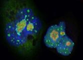 In dieser mikroskopischen Aufnahme ist die lange Version des Transkriptionsfaktors C/EBPalpha grün angefärbt. Im Zellkern verstärkt dieses Steuereiweiß die Produktion von ribosomaler RNA. 