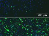 Unter dem Fluoreszenzmikroskop leuchten die Zellen grün, bei denen das Erbgut erfolgreich verändert wurde, blau die ursprünglichen Zellen. Im Vergleich: Transfektion mit PEI, dem bislang üblichen Vektor (oben), unten mit magnetischen Sternpolymeren.