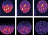 Mühsame Messreihen unter dem Mikroskop erledigt die intelligente Software aus Heidelberg automatisch im Alleingang.