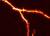 Dendriten, hier als hochauflösende mikroskopische Aufnahme, entscheiden die Signalübertragung.