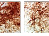 Bei der Parkinson-Krankheit sterben Nervenzellen der schwarzen Substanz im Mittelhirn ab. Im Vergleich ein Schnitt durch ein gesundes Maus-Gehirn (links) und ein erkranktes Hirn (rechts). 