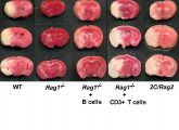 Die roten Flächen mit gesundem Gehirngewebe zeigen es: Mäuse ohne T-Zellen (Rag1-/-) entwickeln kleinere Schlaganfälle als normale Mäuse (WT). Versorgt man Mäuse, denen die T-Zellen fehlen, von außen mit T-Zellen, dann werden beim Schlaganfall wieder größere Areale zerstört (zweite Reihe von rechts).