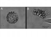 Zelle aus einem Blatt der Ackerschmalwand "Arabidopsis thaliana", befreit von ihrer Zellwand (A). Wird auch noch die Zellmembran entfernt, bleibt die große Vakuole übrig (B).