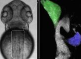 Der Ausschnitt aus einem Zebrafisch-Embryo zeigt die Anlagen für die Leber (grün) und die Bauchspeicheldrüse (violett).