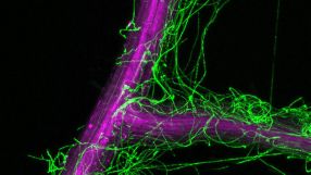 Mikroskopischer Ausschnitt einer Arabidopsis thaliana-Wurzel (violett), die mit Pilzgeflecht von Colletotrichum tofieldiae (grün) umgeben ist. Das Geflecht befindet sich auch innerhalb der Wurzeln.